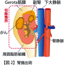 4.治療および手術