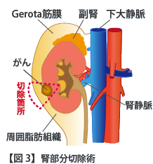 4.治療および手術