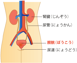 膀胱がんとは