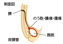 尿膜管側面図
